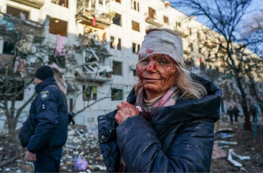  Ουκρανία: Η φρίκη του πολέμου σε μια εικόνα